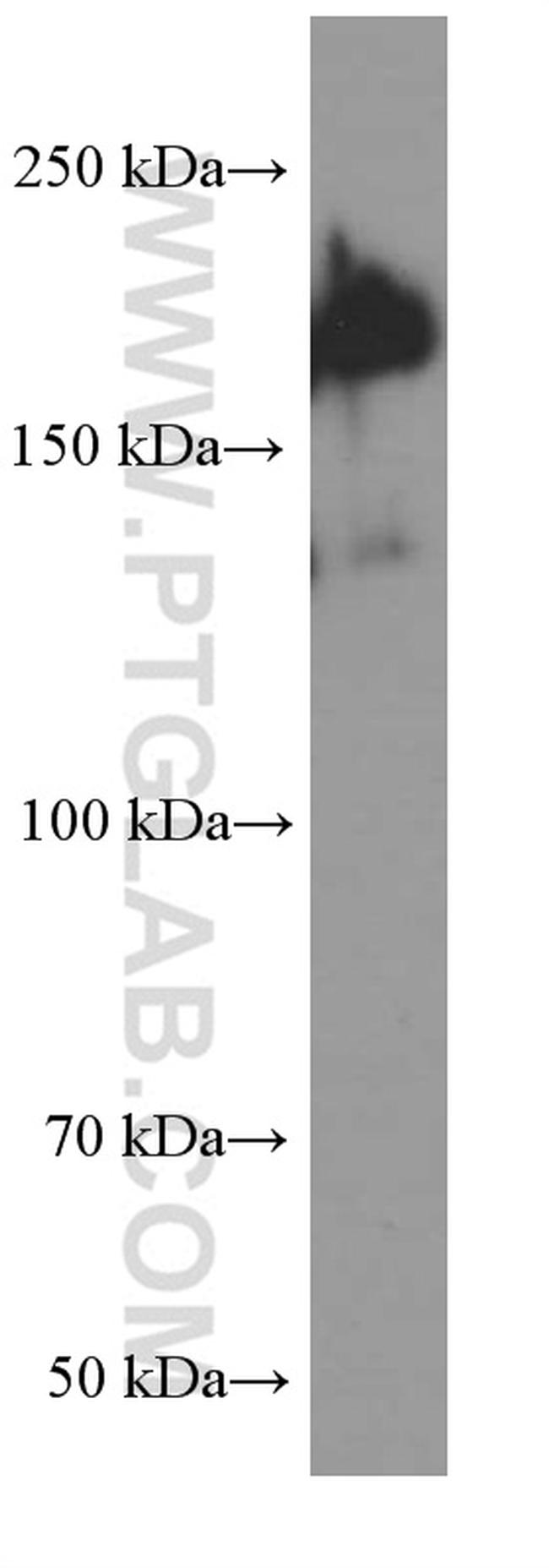 SALL4 Antibody in Western Blot (WB)