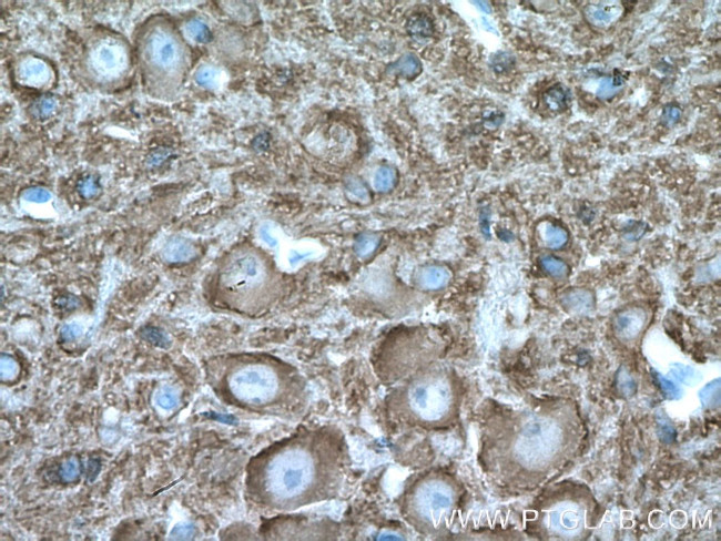 STXBP2 Antibody in Immunohistochemistry (Paraffin) (IHC (P))