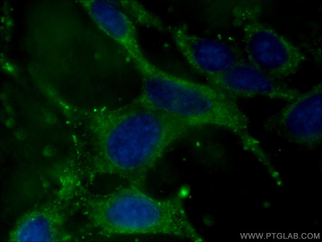 ADIPOQ Antibody in Immunocytochemistry (ICC/IF)