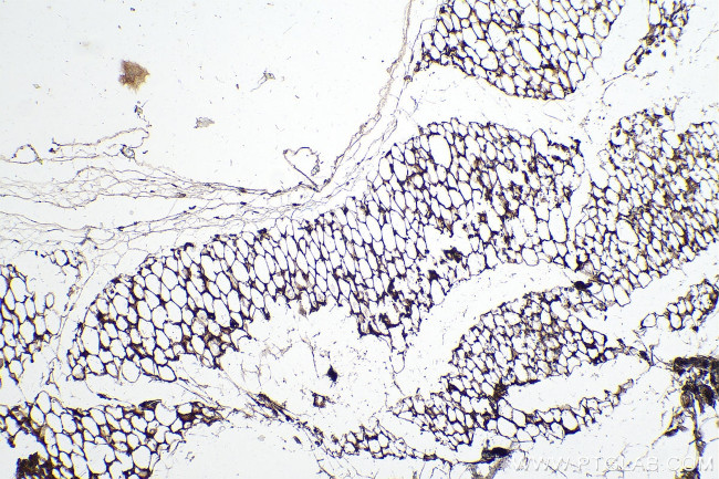 ADIPOQ Antibody in Immunohistochemistry (Paraffin) (IHC (P))