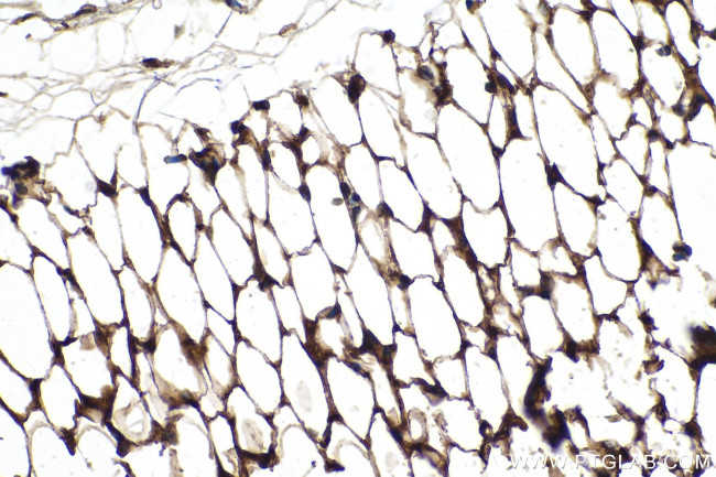 ADIPOQ Antibody in Immunohistochemistry (Paraffin) (IHC (P))