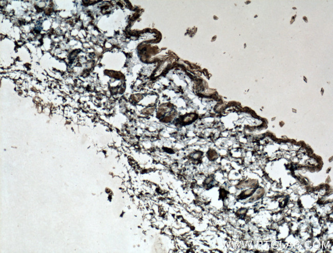 ADIPOQ Antibody in Immunohistochemistry (Paraffin) (IHC (P))