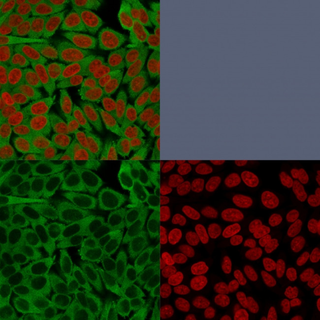 Fascin-1 (Reed-Sternberg Cell Marker) Antibody in Immunocytochemistry (ICC/IF)