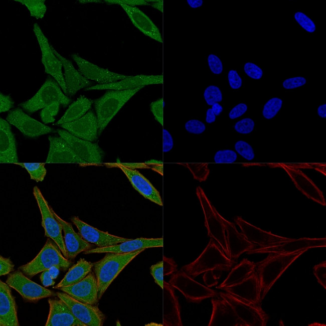Fascin-1 (Reed-Sternberg Cell Marker) Antibody in Immunocytochemistry (ICC/IF)