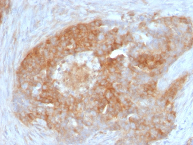 Fascin-1 (Reed-Sternberg Cell Marker) Antibody in Immunohistochemistry (Paraffin) (IHC (P))