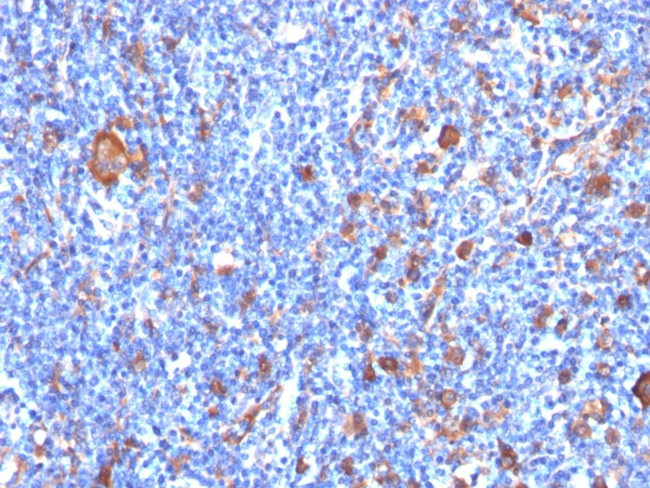 Fascin-1 (Reed-Sternberg Cell Marker) Antibody in Immunohistochemistry (Paraffin) (IHC (P))