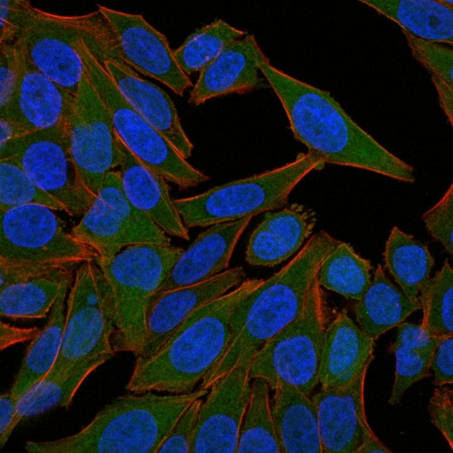 Fascin-1 (Reed-Sternberg Cell Marker) Antibody in Immunocytochemistry (ICC/IF)