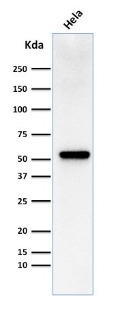 Fascin-1 (Reed-Sternberg Cell Marker) Antibody in Western Blot (WB)