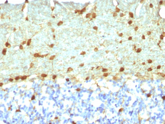 Fascin-1 (Reed-Sternberg Cell Marker) Antibody in Immunohistochemistry (Paraffin) (IHC (P))