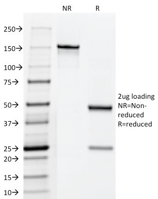 Fascin-1 (Reed-Sternberg Cell Marker) Antibody in SDS-PAGE (SDS-PAGE)