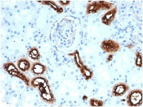 Fascin-1 (Reed-Sternberg Cell Marker) Antibody in Immunohistochemistry (Paraffin) (IHC (P))