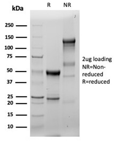 Fascin-1 (Reed-Sternberg CellMarker) Antibody in SDS-PAGE (SDS-PAGE)