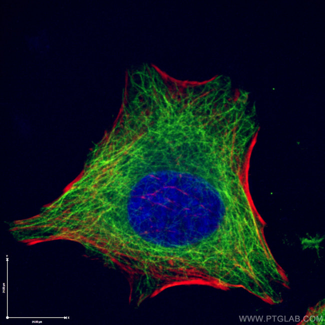 beta Tubulin Antibody in Immunocytochemistry (ICC/IF)