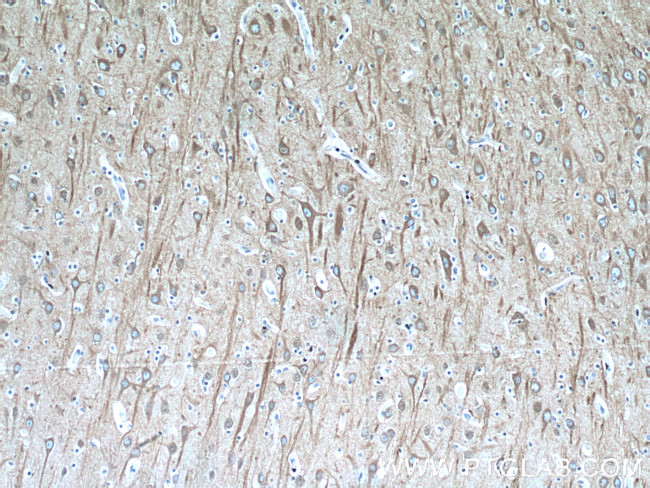 beta Tubulin Antibody in Immunohistochemistry (Paraffin) (IHC (P))