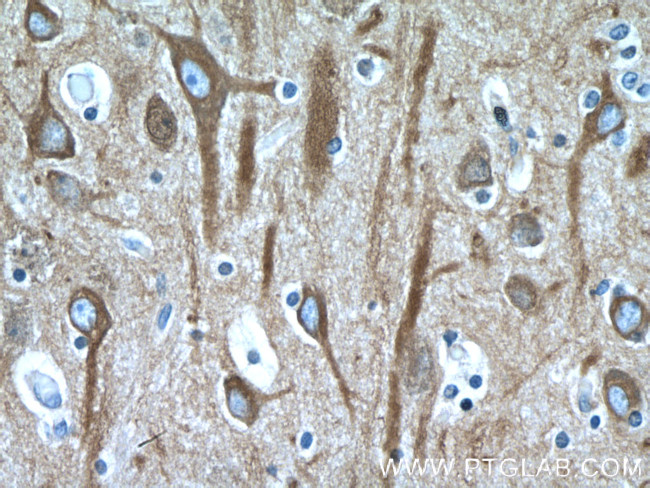 beta Tubulin Antibody in Immunohistochemistry (Paraffin) (IHC (P))