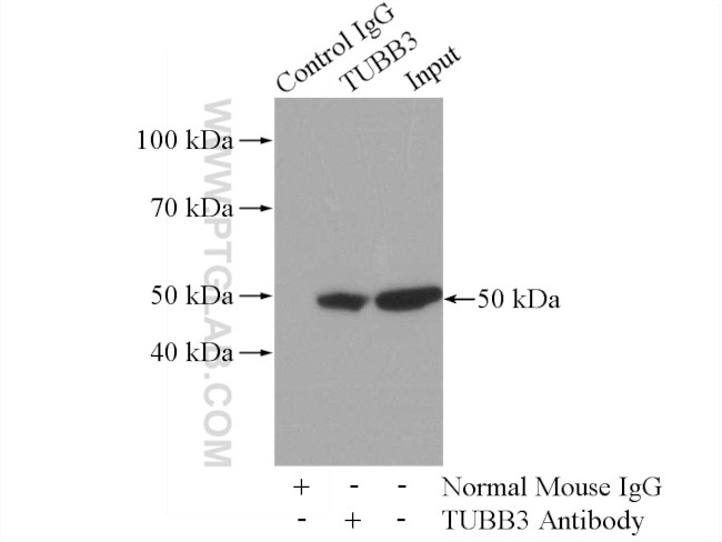 beta Tubulin Antibody in Immunoprecipitation (IP)