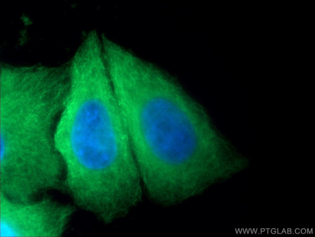 beta Tubulin Antibody in Immunocytochemistry (ICC/IF)