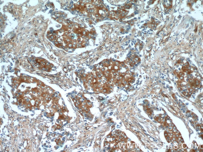 beta Tubulin Antibody in Immunohistochemistry (Paraffin) (IHC (P))