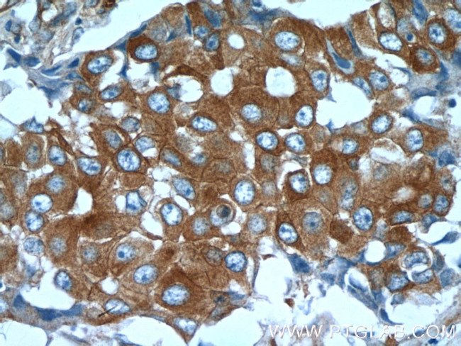 beta Tubulin Antibody in Immunohistochemistry (Paraffin) (IHC (P))