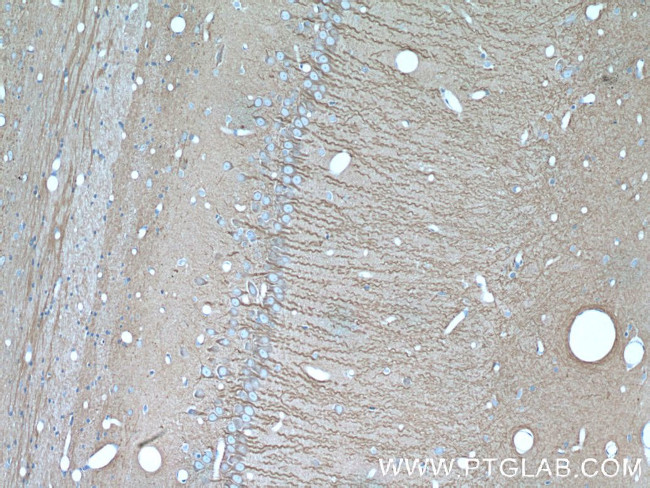 beta Tubulin Antibody in Immunohistochemistry (Paraffin) (IHC (P))