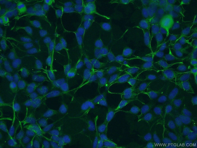 CA9 Antibody in Immunocytochemistry (ICC/IF)