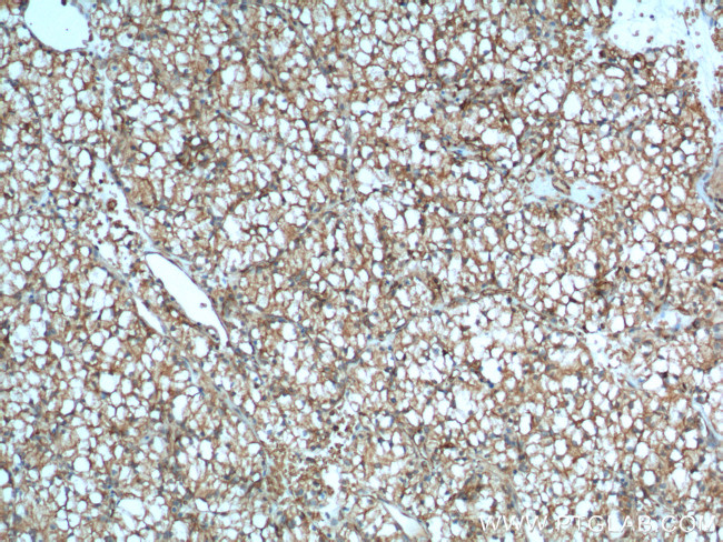 CA9 Antibody in Immunohistochemistry (Paraffin) (IHC (P))