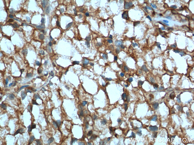 CA9 Antibody in Immunohistochemistry (Paraffin) (IHC (P))