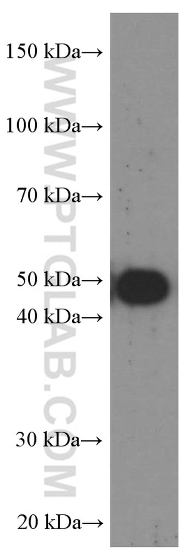 CA9 Antibody in Western Blot (WB)