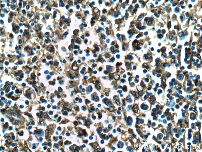 Annexin V Antibody in Immunohistochemistry (Paraffin) (IHC (P))