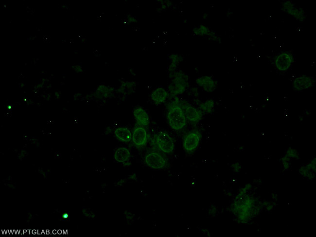 IMP3 Antibody in Immunocytochemistry (ICC/IF)