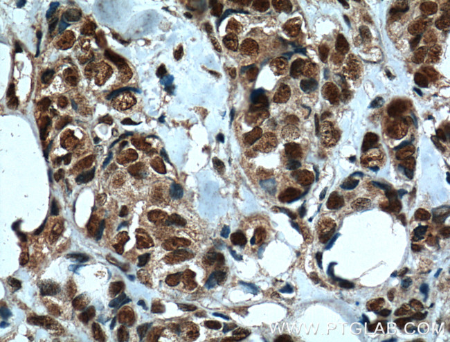 IMP3 Antibody in Immunohistochemistry (Paraffin) (IHC (P))