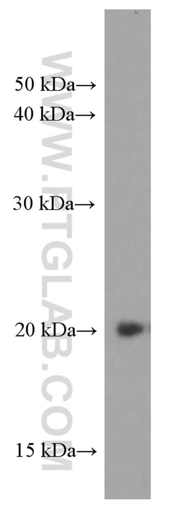 IMP3 Antibody in Western Blot (WB)