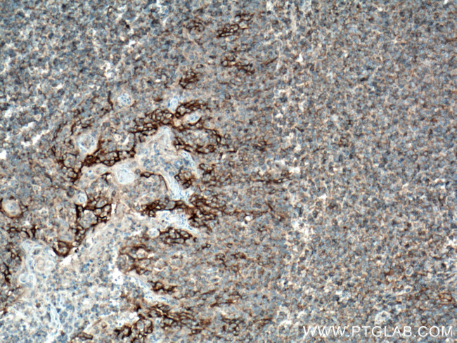 PD-L1/CD274 Antibody in Immunohistochemistry (Paraffin) (IHC (P))