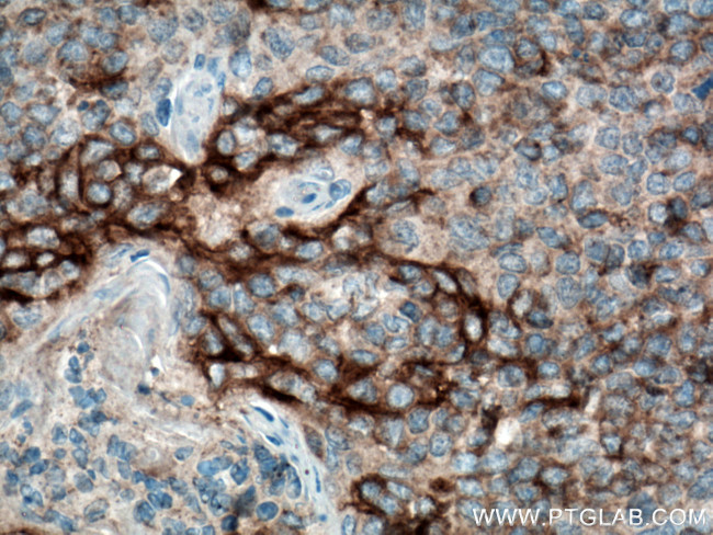 PD-L1/CD274 Antibody in Immunohistochemistry (Paraffin) (IHC (P))