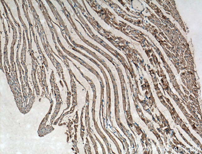 PD-L1/CD274 Antibody in Immunohistochemistry (Paraffin) (IHC (P))