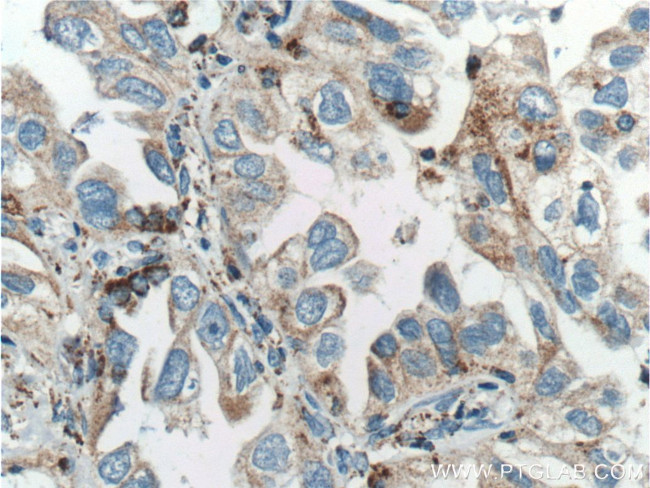 PD-L1/CD274 Antibody in Immunohistochemistry (Paraffin) (IHC (P))