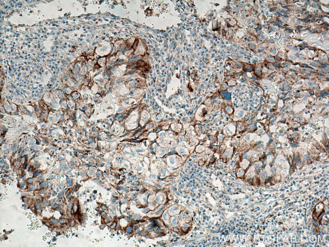 PD-L1/CD274 Antibody in Immunohistochemistry (Paraffin) (IHC (P))