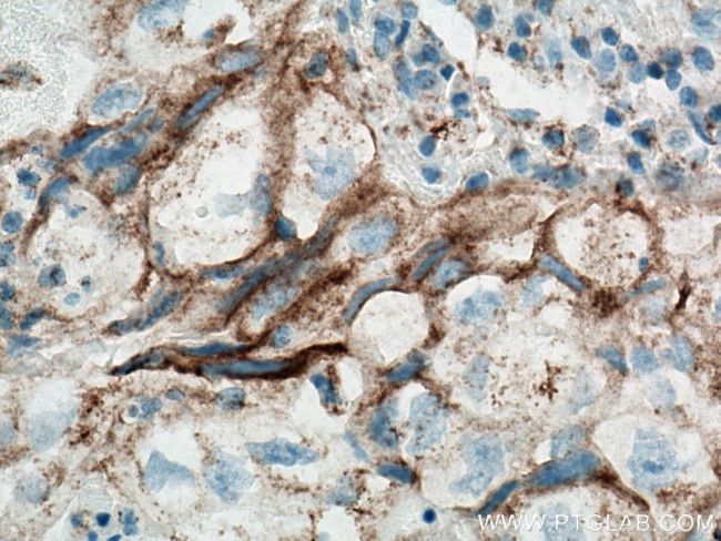 PD-L1/CD274 Antibody in Immunohistochemistry (Paraffin) (IHC (P))