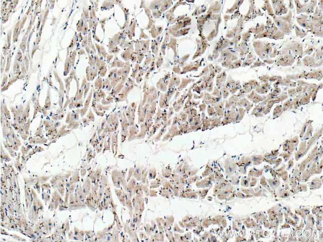 PD-L1/CD274 Antibody in Immunohistochemistry (Paraffin) (IHC (P))