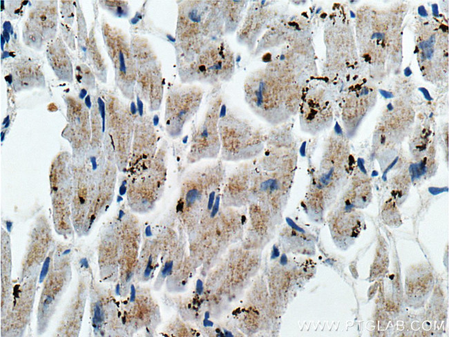 PD-L1/CD274 Antibody in Immunohistochemistry (Paraffin) (IHC (P))