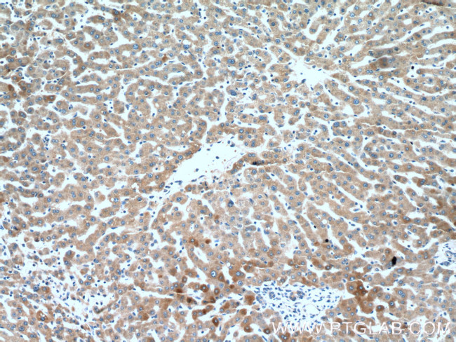 CRP Antibody in Immunohistochemistry (Paraffin) (IHC (P))