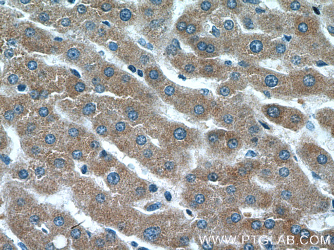 CRP Antibody in Immunohistochemistry (Paraffin) (IHC (P))