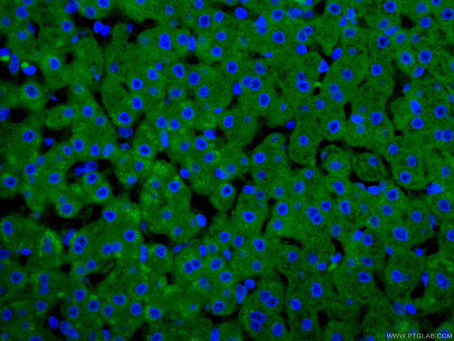 CRP Antibody in Immunohistochemistry (PFA fixed) (IHC (PFA))