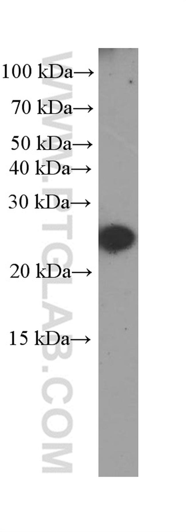 CRP Antibody in Western Blot (WB)