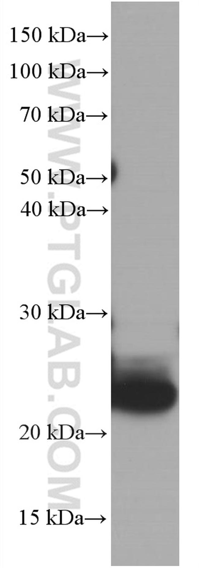 CRP Antibody in Western Blot (WB)