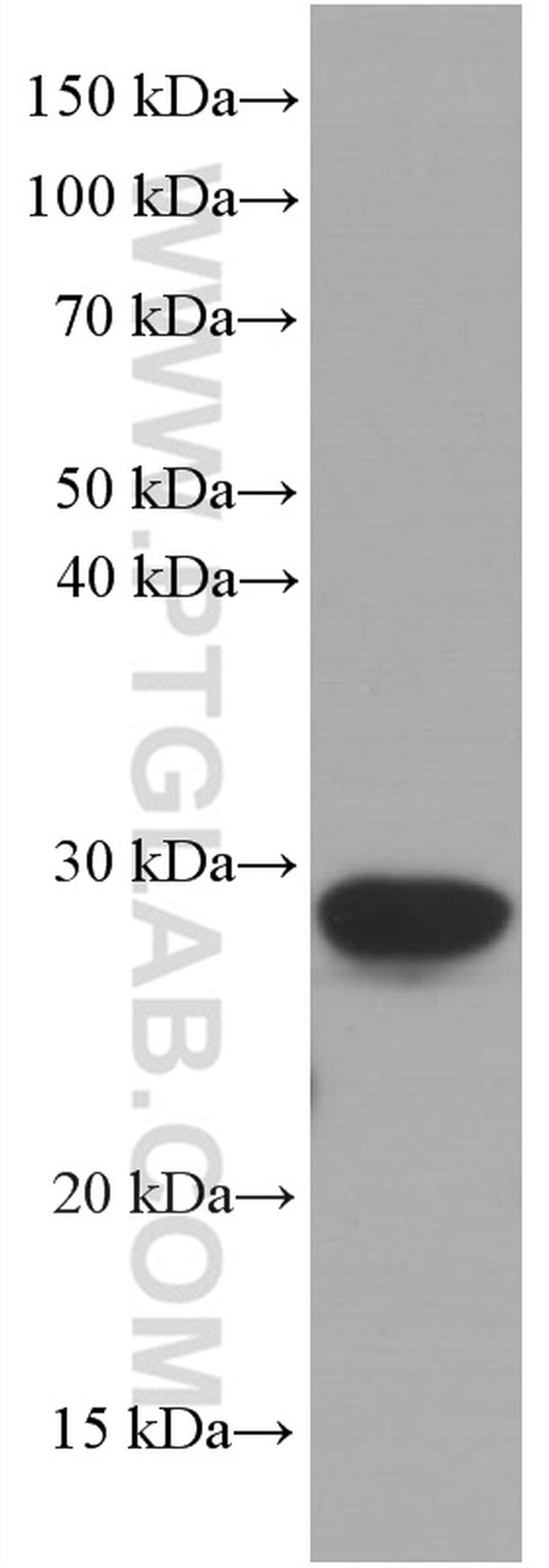 CRP Antibody in Western Blot (WB)