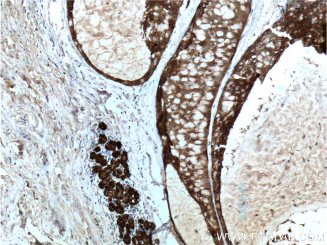 14-3-3 sigma Antibody in Immunohistochemistry (Paraffin) (IHC (P))