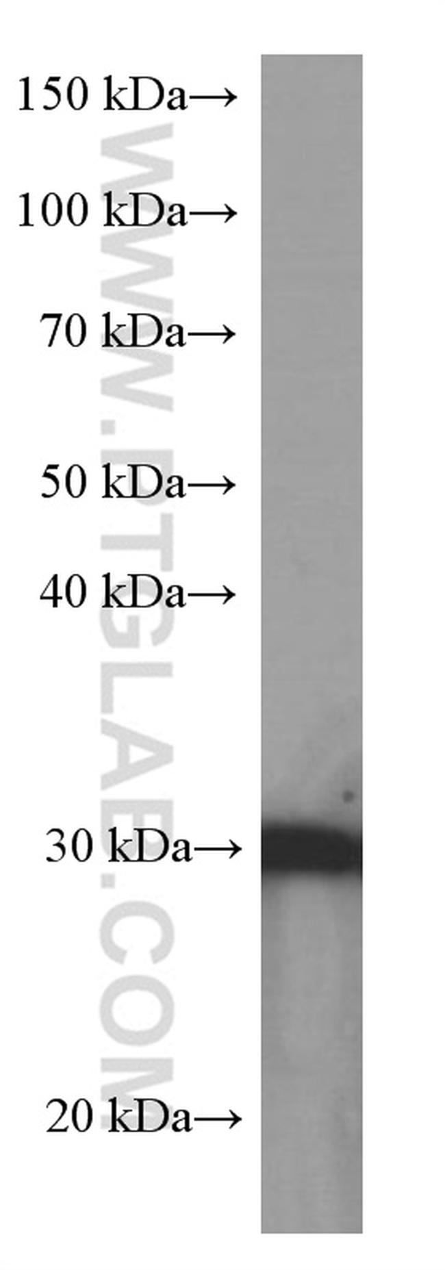 14-3-3 sigma Antibody in Western Blot (WB)