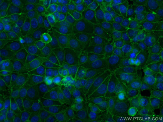 GNAS Antibody in Immunocytochemistry (ICC/IF)