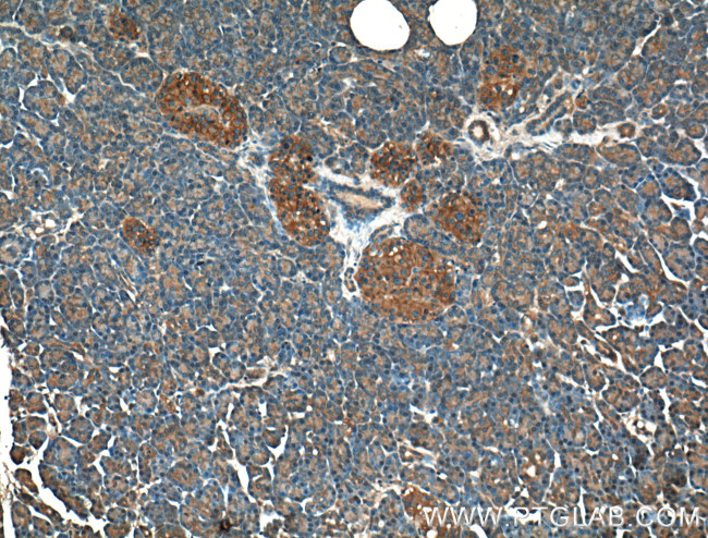 GNAS Antibody in Immunohistochemistry (Paraffin) (IHC (P))